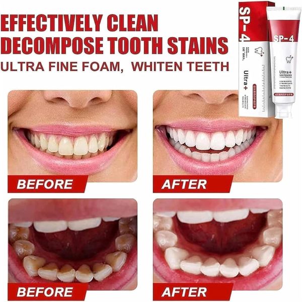 Sp-4 Toothpaste Sp-4 Ultra Whitening