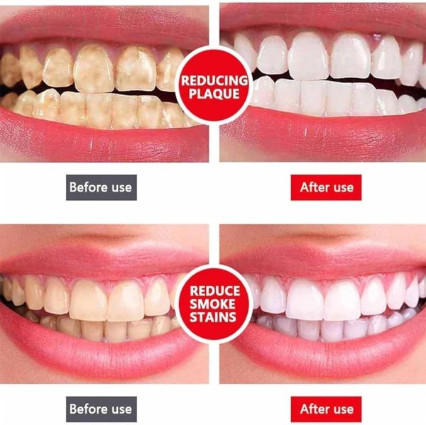 Sp-4 Toothpaste Sp-4 Ultra Whitening